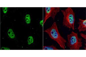 ICC/IF Image CHK1 antibody [C1C2-6], Internal detects Chk1 protein at nucleus by immunofluorescent analysis. (CHEK1 抗体)