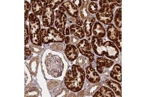 Immunohistochemical staining of human kidney with KRT78 polyclonal antibody  shows strong granular cytoplasmic positivity in cells in renal tubules. (Keratin 78 抗体)