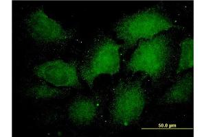 Immunofluorescence (IF) image for anti-Proteasome Subunit alpha Type 1 (PSMA1) (AA 1-263) antibody (ABIN562469)