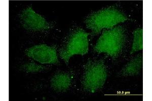 Immunofluorescence of monoclonal antibody to PSMA1 on HeLa cell.