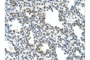 Immunohistochemistry (IHC) image for anti-Naked Cuticle Homolog 1 (NKD1) (N-Term) antibody (ABIN310131) (NKD1 抗体  (N-Term))