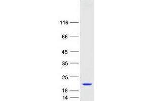 Western Blotting (WB) image for Centrin, EF-Hand Protein, 3 (CETN3) protein (Myc-DYKDDDDK Tag) (ABIN2713917)