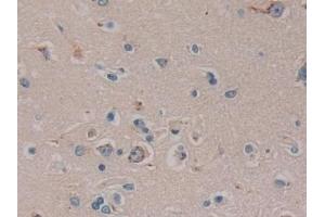 Immunohistochemistry (IHC) image for anti-Family with Sequence Similarity 3, Member C (FAM3C) (AA 25-227) antibody (ABIN7443470)