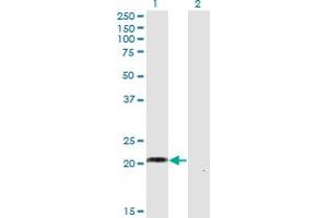 Western Blot analysis of WISP2 expression in transfected 293T cell line by WISP2 monoclonal antibody (M02), clone 1E11. (WISP2 抗体  (AA 24-250))