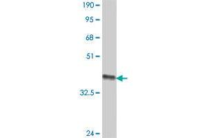 Western Blot detection against Immunogen (36. (RAB33B 抗体  (AA 117-206))