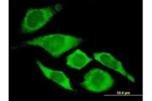 Immunofluorescence of monoclonal antibody to CDKN1A on HeLa cell.