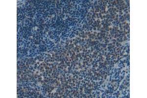 #VALUE! (Signaling Lymphocytic Activation Molecule Family, Member 2 (AA 27-243) 抗体)