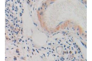 Immunohistochemistry (IHC) image for anti-Glycine Dehydrogenase (GLDC) (AA 81-268) antibody (ABIN7438277)