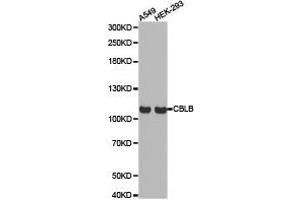 Western Blotting (WB) image for anti-Cbl Proto-Oncogene B, E3 Ubiquitin Protein Ligase (CBLB) antibody (ABIN1871488) (Cbl Proto-Oncogene B, E3 Ubiquitin Protein Ligase (CBLB) 抗体)