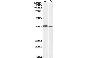 ABIN184999 staining (1µg/ml) of A549 (A) and PD19 (B) cell lysate (RIPA buffer, 30µg total protein per lane). (PCGF2 抗体  (C-Term))