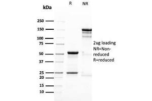 SDS-PAGE Analysis Purified Nestin Mouse Monoclonal Antibody (NES/2911). (Nestin 抗体  (AA 698-844))