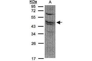 WB Image Sample(30 μg of whole cell lysate) A:A431, 12% SDS PAGE antibody diluted at 1:1500 (FDFT1 抗体)