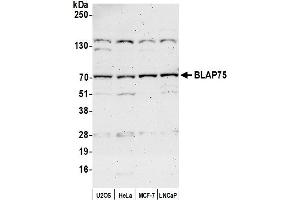 anti-Homolog of Yeast RecQ-mediated Genome Instability 1 (RMI1) (AA 275-300) antibody