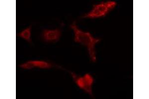 ABIN6274274 staining HuvEc cells by IF/ICC.