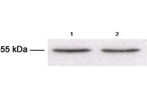 Western Blotting (WB) image for anti-Tubulin, beta 3 (TUBB3) antibody (ABIN1109374) (TUBB3 抗体)