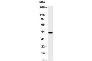 Western Blotting (WB) image for anti-Hydroxysteroid (17-Beta) Dehydrogenase 2 (HSD17B2) (AA 373-387) antibody (ABIN3031272)