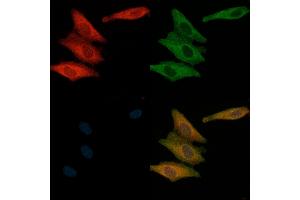 ABIN6265950 and ABIN6269155 staining  cells(H2O2 treatment) by IF/ICC.