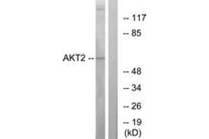 Western blot analysis of extracts from A2780 cells, treated with TNF-alpha, using Akt2 (Ab-474) Antibody. (AKT2 抗体  (AA 432-481))