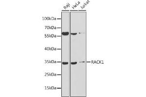Western blot analysis of extracts of various cell lines, using R antibody (ABIN6131708, ABIN6141226, ABIN6141228 and ABIN6217372) at 1:1000 dilution. (GNB2L1 抗体  (AA 30-290))