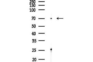 Western blot analysis of lysates from MDA-MB-231 cells(heat-shock,45 min treatment), using TRIP10 Antibody at 1/1000 dilution.