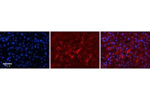 Rabbit Anti-LYPLA2 Antibody  Catalog Number: ARP58638_P050 Formalin Fixed Paraffin Embedded Tissue: Human Adult Liver  Observed Staining: Cytoplasm in hepatocytes, strong signal, low tissue distribution Primary Antibody Concentration: 1:100 Secondary Antibody: Donkey anti-Rabbit-Cy3 Secondary Antibody Concentration: 1:200 Magnification: 20X Exposure Time: 0. (LYPLA2 抗体  (N-Term))
