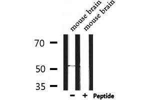 Western blot analysis of extracts from mouse brain, using ETBR2 Antibody. (GPR37L1 抗体  (N-Term))