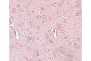 Immunohistochemistry of TRESK in rat brain tissue with this product at 5 μg/ml. (KCNK18 抗体  (Center))