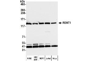 anti-UPF1 Regulator of Nonsense Transcripts Homolog (UPF1) (AA 1079-1129) antibody