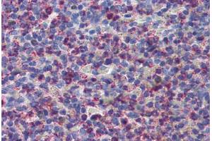 Anti-CYSLTR2 / CYSLT2 antibody  ABIN1048489 IHC staining of human spleen. (CasLTR2 抗体  (Extracellular Domain))