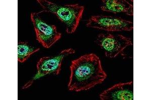 Fluorescent confocal image of HeLa cell stained with TFE3 antibody. (TFE3 抗体  (AA 1-30))
