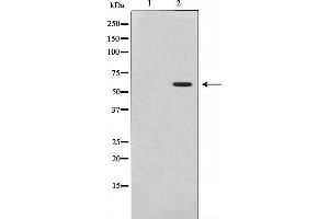Western blot analysis of Akt phosphorylation expression in Insulin treated 293 whole cell lysates,The lane on the left is treated with the antigen-specific peptide. (AKT1 抗体  (pThr308))