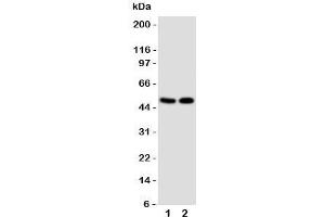 Western blot testing of VDR antibody and Lane 1:  MCF-7;  2: HeLa cell lysate. (Vitamin D Receptor 抗体  (C-Term))