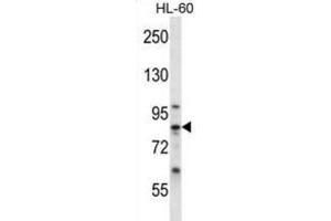 Western Blotting (WB) image for anti-Calpain 6 (CAPN6) antibody (ABIN2996811) (Calpain 6 抗体)