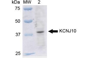 Western blot analysis of Rat Liver cell lysates showing detection of ~42. (KCNJ10 抗体  (APC))