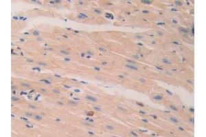 Immunohistochemistry (IHC) image for anti-Laminin, beta 2 (Laminin S) (LAMB2) (AA 1498-1716) antibody (ABIN7438904)