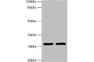 Western blot All lanes: ACRV1 antibody at 4 μg/mL Lane 1: Mouse liver tissue Lane 2: Mouse gonad tissue Secondary Goat polyclonal to rabbit IgG at 1/10000 dilution Predicted band size: 29, 27, 23, 21, 20, 19, 18, 17, 14, 9 kDa Observed band size: 29 kDa (ACRV1 抗体  (AA 22-265))