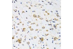 Immunohistochemistry (Paraffin-embedded Sections) (IHC (p)) image for anti-Coatomer Protein Complex, Subunit beta 2 (COPB2) (AA 657-906) antibody (ABIN6138871)