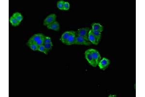 Immunofluorescent analysis of HepG2 cells using ABIN7150865 at dilution of 1:100 and Alexa Fluor 488-congugated AffiniPure Goat Anti-Rabbit IgG(H+L) (DNAH12 抗体  (AA 2423-2632))
