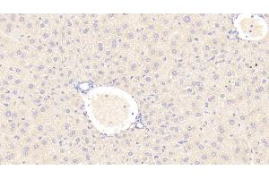 Detection of C1INH in Mouse Liver Tissue using Polyclonal Antibody to Complement 1 Inhibitor (C1INH)