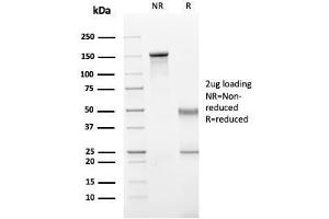 SDS-PAGE Analysis Purified IgG Mouse Recombinant Monoclonal Antibody (rIG266). (Recombinant IGHG 抗体)