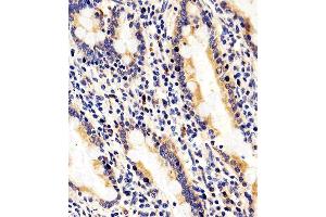 Immunohistochemical analysis of paraffin-embedded H. (RAB35 抗体  (C-Term))