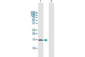 Western Blot analysis of ZNRD1 expression in transfected 293T cell line by ZNRD1 MaxPab polyclonal antibody. (ZNRD1 抗体  (AA 1-126))