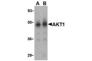 Western blot analysis of Akt1 in human liver cell lysate with AP30042PU-N Akt1 antibody at (A) 1 and (B) 2 μg/ml. (AKT1 抗体)