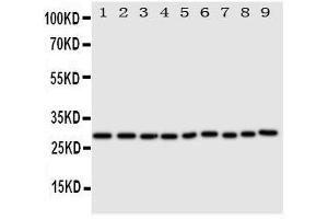 Anti-Peroxiredoxin 3 antibody, Western blotting All lanes: Anti Peroxiredoxin 3  at 0.