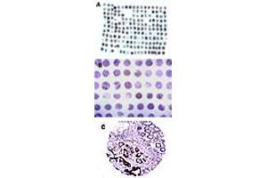 Formalin-fixed, paraffin-embedded tissue human colon microarray stained for CARD8 expression at 1 : 2000. (CARD8 抗体)