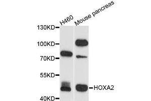 Western blot analysis of extracts of various cell lines, using HOXA2 antibody (ABIN5995946) at 1/1000 dilution. (HOXA2 抗体)