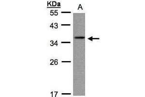 WB Image Sample(30 ug whole cell lysate) A:A431, 12% SDS PAGE antibody diluted at 1:1000 (CRYGC 抗体)