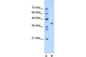Western Blotting (WB) image for anti-Transmembrane Protein 59-Like (TMEM59L) antibody (ABIN2463023) (TMEM59L 抗体)