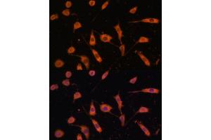 Immunofluorescence (IF) image for anti-Transmembrane Protein 173 (TMEM173) (AA 170-379) antibody (ABIN1683049)