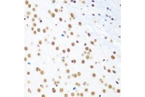 Immunohistochemistry of paraffin-embedded mouse brain using CTCF antibody at dilution of 1:100 (40x lens). (CTCF 抗体)